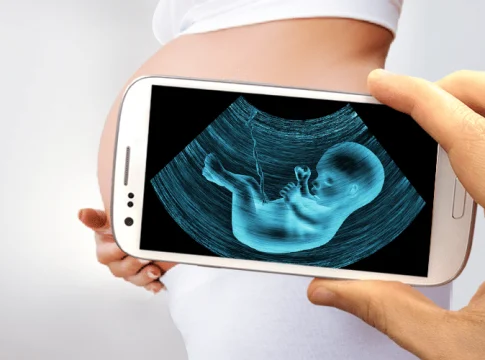 Aplicativos para fazer ultrassom pelo celular