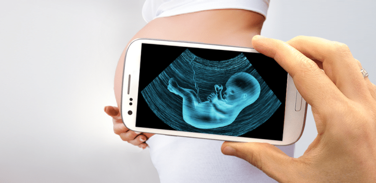 Applications to perform ultrasound on your cell phone