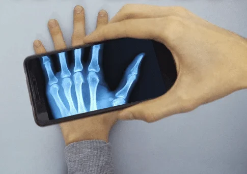 Os melhores aplicativos para simular Raio-X no seu celular