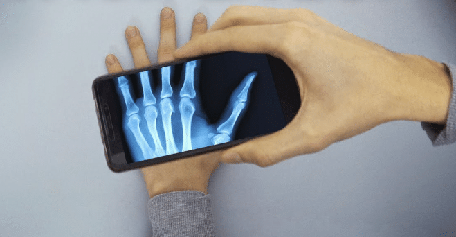 The best apps to simulate X-rays on your cell phone