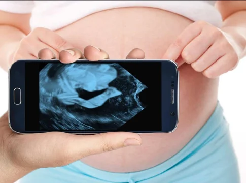 Descubra os melhores aplicativos para fazer ultrassom pelo celular