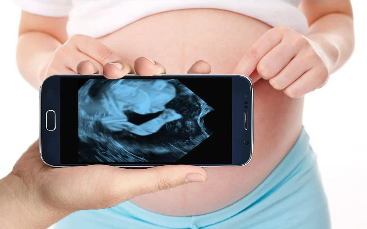 Discover the best apps for doing ultrasound on your cell phone